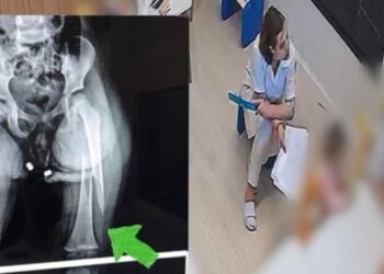 Dhuna ndaj të miturës në kopshtin e Tiranës, reagon MAS: Të merren masa…