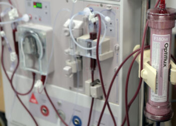 Dializa, raporti i KLSH nxjerr zbuluar mungesën e investimeve nga koncesionari