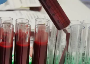 Një pyetje me rëndësi jetike – A di se ç’grup e ke gjakun?