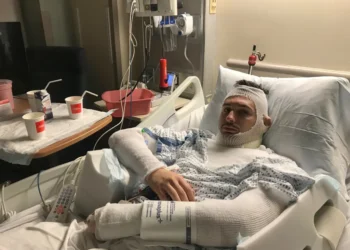 Skenë si në filma! Kush është i riu shqiptar që shpëtoi të dashurën nga flakët