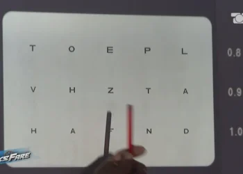 2.5 mln lekë për një kemp verbërie, zbulohet skema: 500 mijë mjekja me sekserin