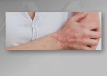 Shtohen rastet e zgjebjes në Shqipëri