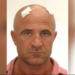 Kreshnik Farruku vetëdorëzohet në Policinë e Durrësit