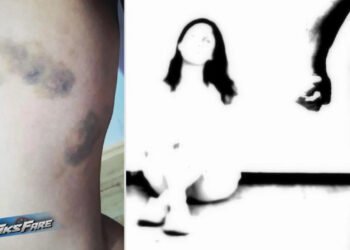 “Nga dhuna e burrit humba fëmijën”, nëna e dy të miturve kërkon drejtësi