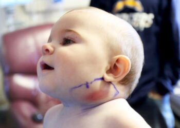 Rreziku nga gëlltitja e objekteve te fëmijët, mjekja: Lodrat magnetike dhe bateritë mund të shpojnë zorrët