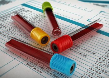 Shok në QSUT/ Urdhëri ndal analizat: nuk ka më buxhet për pacientët