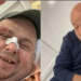 Dhunohet personazhi i njohur i rrjeteve sociale Genard Hajdini dhe babai i tij