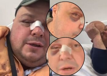 Goditi me grusht Genard Hajdinin dhe babain e tij, nis hetimi për 40-vjeçarin