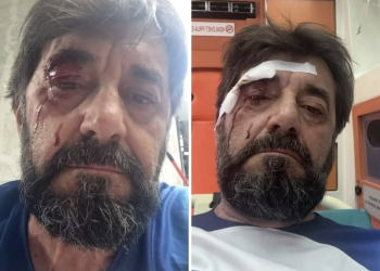 Dhunohet analisti Ilir Demaliaj, Policia shpall në kërkim autorin e dyshuar dhe sekuestron makinën