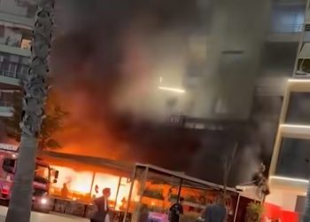 E rëndë pas zjarrit në Hotel “Brooklyn”/ U dogj në 85% të trupit, 25-vjeçarja dërgohet për trajtim të specializuar në Turqi
