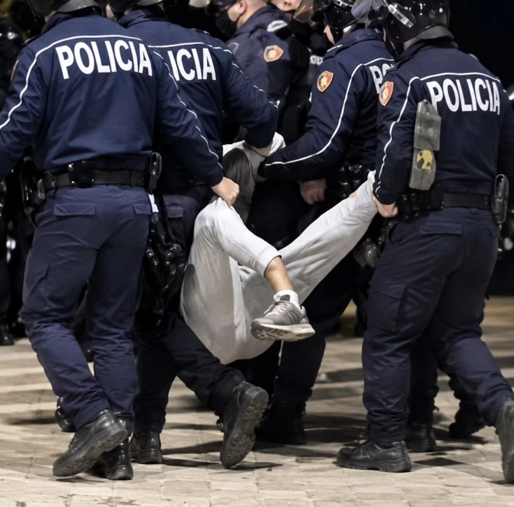 Dhuna policore në protestë  operohet 19 vjeçari me këmbë të thyer