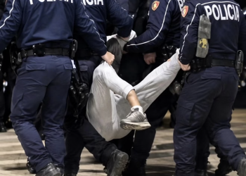 Dhuna policore në protestë, operohet 19-vjeçari me këmbë të thyer